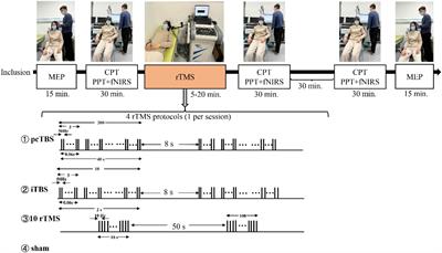 Prolonged Continuous Theta Burst Stimulation Can Regulate Sensitivity on Aβ Fibers: An Functional Near-Infrared Spectroscopy Study